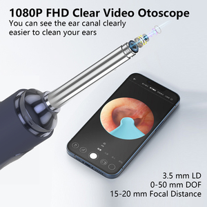 Vente en gros de nettoyeur d'oreille endoscopique pour bébé adulte Nettoyeur d'oreille visuel intelligent sans fil Otoscope Outil de retrait de cire d'oreille avec caméra - Product Image 5