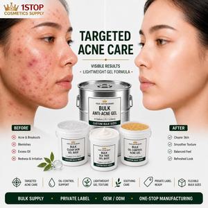 Crème <span class=keywords><strong>anti</strong></span>-taches R&D Marché Nordique Amélioration Peaux à Tendance Acnéique <span class=keywords><strong>Anti</strong></span>-Rougeurs Emballage Durable Stable à Basse Température - Product Image 1