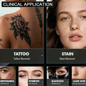 Máquina Láser Nd de Picosegundos de 2000W, la Más Popular en la UE, para Eliminación de Tatuajes, Eliminación de Manchas de Sangre, Atenuación de Cicatrices y Peeling de Carbono - Product Image 4