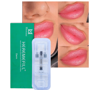 Heremefiller Gel Injectable d'Acide Hyaluronique Réticulé à Marque Privée pour <span class=keywords><strong>Augmentation</strong></span> <span class=keywords><strong>des</strong></span> Lèvres et Remplissage Dermique - Product Image 6