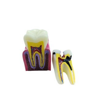 Equipo de Enseñanza Dental Manual <span class=keywords><strong>FURIEN</strong></span> SMILE, Modelo de Contraste de 6 Pliegues para Detección de Caries, Clase II, Certificado CCC, Uso Comercial y Doméstico - Product Image 1