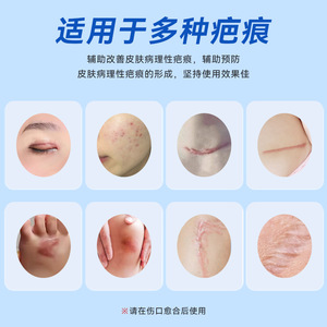 Chenkang Medical Silicone Scar Gel 2g 7g 15g 20g 60g For Burn Scald Trauma Scar Fading Cesarean Section Post Aesthetic Use - Product Image 4