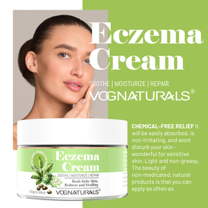 Crema Herbal <span class=keywords><strong>para</strong></span> Eczema de Marca Privada, Hidratante, Nutritiva <span class=keywords><strong>para</strong></span> la Piel, Tratamiento <span class=keywords><strong>para</strong></span> <span class=keywords><strong>Dermatitis</strong></span> y Psoriasis, Sin Esteroides, Calmante y Anti-Picazón - Product Image 6