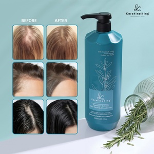 OEM ODM Private Label <b>Shampoo</b> Natural Rosemary Set Organic Vegan Ginger Hair <b>Shampoo</b> Clear Fluffy Oil-control Hair Care Set - Product Image 3