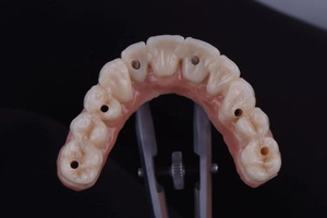 Blocco di <span class=keywords><strong>Zirconia</strong></span> Multistrato per Fresatura di Corone e Impianti Dentali Elettrici, Disco 3D Promax Kingch - Product Image 5