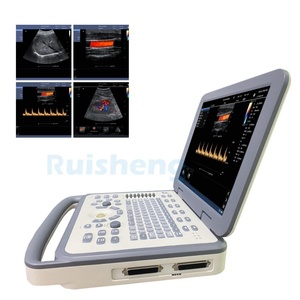 Système d'échographie portable professionnel RS-N30, meilleur appareil d'échographie portable de Chine, scanner couleur <span class=keywords><strong>Doppler</strong></span> - Product Image 1