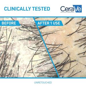 Acondicionador Hidratante Anticaspa al por Mayor con 0.5% de Piritiona de Zinc, 9 Fl Oz, Ceramidas Líquidas, Ácido Hialurónico y Fragancia - Product Image 5