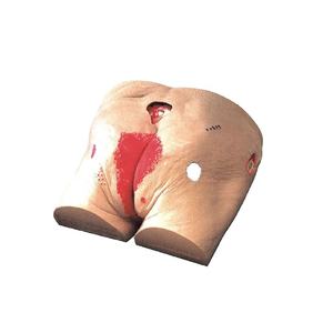 Modelo Avançado de Cuidados com Úlceras por Pressão DARHMMY para Treinamento em Enfermagem - Product Image 1