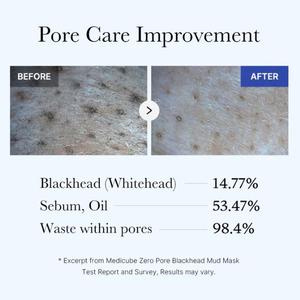 Hàn Quốc cho medicube Zero lỗ chân lông mặt mũi lỗ chân lông làm săn chắc salicylic axit mụn đầu đen bùn mặt nạ bán buôn Hàn Quốc sản phẩm chăm sóc da sâu - Product Image 4