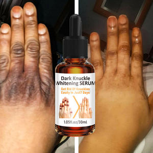 Huile Essentielle Hydratante et Éclaircissante pour Jointures Sombres à Marque Blanche, à base de Niacinamide, pour l'Estompement des Taches Pigmentaires - Product Image 3