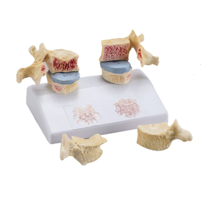 Model pengajaran medis sains medis Model Oba tulang manusia - Product Image 3