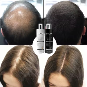 Marque privée <span class=keywords><strong>Shampooing</strong></span> antichute à la biotine <span class=keywords><strong>Shampooing</strong></span> et après-shampoing bio pour la croissance des cheveux - Product Image 2