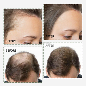 Siero per la Crescita dei Capelli con Estratto di Cipolla e Olio di Rosmarino, Formula Botanica per la Cura del Cuoio Capelluto, Logo Personalizzato - Product Image 5