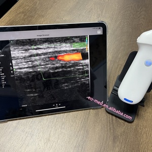 USB&WiFi Ultrasound <b>Scanner</b> CU120 <b>Handheld</b> Facial Ultrasound Probe Made in China - Product Image 6