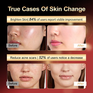 दर्द राहत के लिए सौंदर्य लेजर प्रकाश चिकित्सा पैनल 1200 एक्स 300 शेनजेन विचार सौर लाल प्रकाश चिकित्सा स्टैंड के लिए प्रकाश चिकित्सा पैनल - Product Image 4