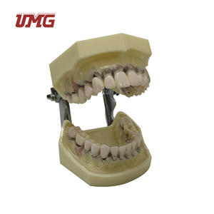 Model penyakit periodalat-alat dengan transparan demografis permen karet vagina ginives - Product Image 6