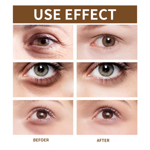 Migliore Coreano Cura Della Pelle Levigante Riparazione Degli Occhi <span class=keywords><strong>Crema</strong></span> <span class=keywords><strong>Per</strong></span> Gli Occhi Sacchetto - Product Image 6