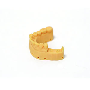 Résine dentaire Yidimu 1 kg/5 kg, résine photopolymère soluble dans l'eau, faible odeur, facile à nettoyer, haute précision, résine d'impression 3D 405 nm - Product Image 3