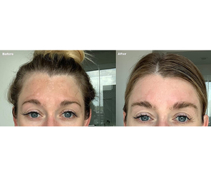 Oem Sắc Tố Tàn Nhang Sáng Whiting Chống Lão Hóa Mặt Huyết Thanh Chăm Sóc Da Làm Trắng Dark Spot Loại Bỏ Corrector Huyết Thanh Mặt - Product Image 4