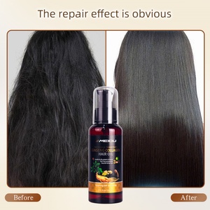 Aceite Capilar de Romero para el Crecimiento del Cabello, el Mejor Aceite Capilar Indio al por Mayor - Product Image 6