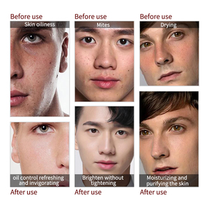 Mencare OEM Người Đàn Ông Của Kiểm Soát Dầu Da Sữa Rửa Mặt Làm Mới Bọt Rửa Mặt Với Loại Bỏ Mite Bởi Người Đàn Ông Của Chăm Sóc - Product Image 5
