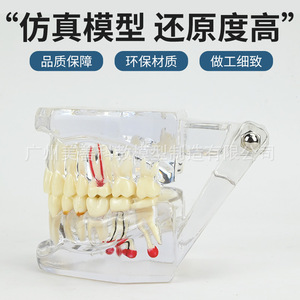 Modelos dentales, modelos de patología dental transparentes naturales, modelos de patología dental y modelos médico-paciente. - Product Image 4