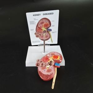 KyrenMed umano malato di anatomia del rene con calcoli urinari tumori malattia policistica a grandezza naturale modello di rene patologico - Product Image 3