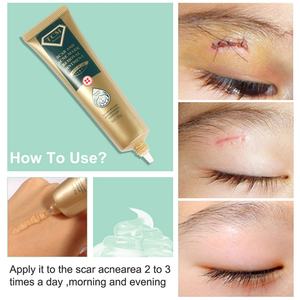 Gel Reparador de Piel Natural TCM de 30g, Venta al por Mayor de Fábrica, Mascarilla para Eliminar Cicatrices y Acné, Ungüento con Arbutina como Ingrediente Principal, Uso Diario - Product Image 4