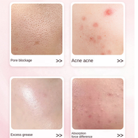 Nettoyeur facial électrique à vibrations multi-vitesses pour le visage et le nez, nettoyage en profondeur des pores, brosse nettoyante sonique vibrante pour le visage