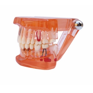 Modelo de Implante Dental, Modelo de Práctica de Restauración Dental - Product Image 3