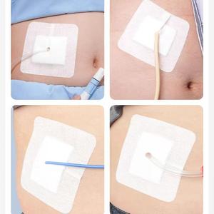 Pansement de drainage stérile perforé de qualité médicale pour cathéters externes, drainage péritonéal transluminal, drainage des voies biliaires, biopsie rénale - Product Image 1