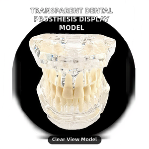 Hotseller NieuwBeijing TIANLIAN Transparant Anatomisch Tandmodel Prothese Implantaat Pathologisch Displaymodel - Product Image 3