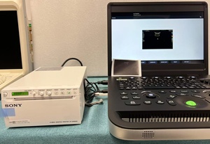 Échographe Doppler couleur tactile avec sonde à réseau phasé haute performance et sonde micro-convexe et sonde à réseau linéaire standard - Product Image 6