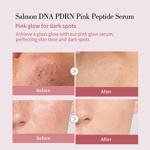 Sérum Coreano de Péptidos Rosados con ADN de Salmón PDRN para Cuidado de la Piel Efecto Cristalino Hidratante Reafirmante para Piel Irregular de Marca Propia OEM - Product Image 2