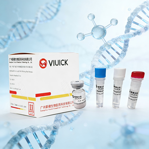 Kit de test PCR CCHF pour <span class=keywords><strong>la</strong></span> fièvre hémorragique du Congo de Crimée, diagnostic PCR en temps réel, IVD certifié ISO13485, modè<span class=keywords><strong>le</strong></span> NCEP-R-5131 1 - Product Image 2