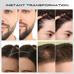 Fibras Capilares NIZORICK <span class=keywords><strong>para</strong></span> Zonas Calvas, Disimulan la Pérdida de Cabello de Forma Instantánea, Fibras Capilares de Proteína <span class=keywords><strong>para</strong></span> Hombre - Product Image 5