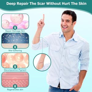 Aixin Private Scar Repair Advanced Scar Gel <span class=keywords><strong>ayuda</strong></span> <span class=keywords><strong>a</strong></span> mejorar la reparación de cicatrices antiguas y nuevas humedecer sin secar Gel reparador - Product Image 6