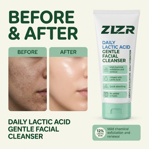 Espuma Limpiadora Facial con Ácido Láctico 12% AHA, Exfoliante, Limpieza Profunda, Suave, para Piel Opaca, Áspera, Irregular, Propensa al Acné, para Todo Tipo de Piel - Product Image 5