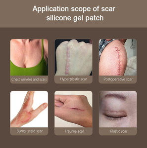 Patchs en silicone de haute qualité pour les cicatrices traitement thérapie réparation enlèvement Gel Silicone <span class=keywords><strong>cicatrice</strong></span> <span class=keywords><strong>Patch</strong></span> - Product Image 3