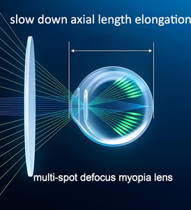 Lentilles optiques multi-vision pour enfants, contrôle de la <span class=keywords><strong>myopie</strong></span>, <span class=keywords><strong>prix</strong></span> d'usine chinois - Product Image 4
