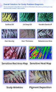 Analizador de cabello profesional inteligente con IA y tecnología 3D para detector de folículos capilares - Product Image 6
