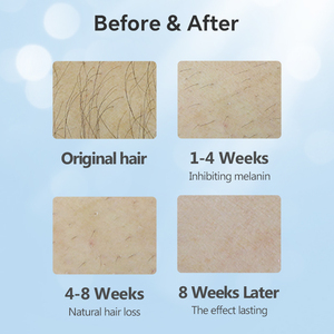 T3 Modell 500000 36W Home IPL Machine <span class=keywords><strong>Photon</strong></span> Beauty Instrument zur Laser-Haaren tfernung mit mehreren Effekten - Product Image 6