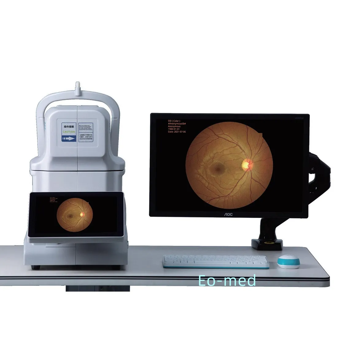 Laser Ophthalmic Fundus Camera Digital Non-mydriatic Fundus Camera New arrival ophthalmology equipment YDC11