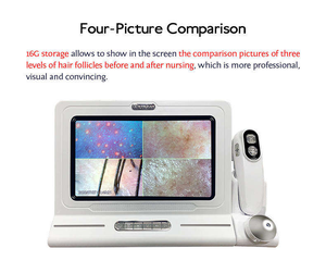 Alta definición 3D Digital Hair Scalp Analysis Máquina de terapia capilar Detección de humedad del aceite de la piel Dispositivo de diagnóstico del cuero cabelludo - Product Image 5