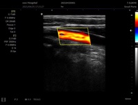 Échographe portable pour centre d'imagerie médicale diagnostique, équipement d'échographie vétérinaire ou humaine