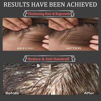Esensi Penumbuh Rambut Universal untuk Pria dan Wanita. Produk Perawatan Rambut Anti-Rontok Herbal Organik yang Menutrisi.
