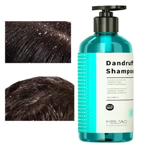 MELAO Anti Dandruff Remover Shampoo For Black Women Deep Cleansing Salon Organic Prevents Hairloss Dandruff Shampoo