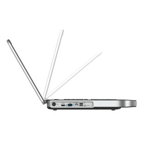 SN10Pro Portable Ultrasound Machine 15.6" HD Display Windows 7 THI <strong>Imaging</strong> 3D Option 4 Hours Battery IMT Auto Medical Equipment - Product Image 1