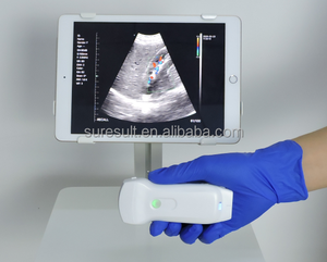 Máquina de fisioterapia inalámbrica Suresult 2022 de alta FPS, escáneres de mano, ultrasonido Doppler portátil - Product Image 4