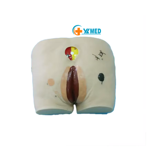 Modèle de soins infirmiers Ulcère de pression pour personnes âgées Modèle d'<span class=keywords><strong>escarre</strong></span> de science médicale pour les patients - Product Image 1